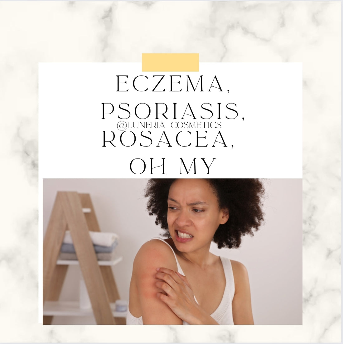 Eczema vs Psoriasis vs Rosacea: What are the similarities and differences?